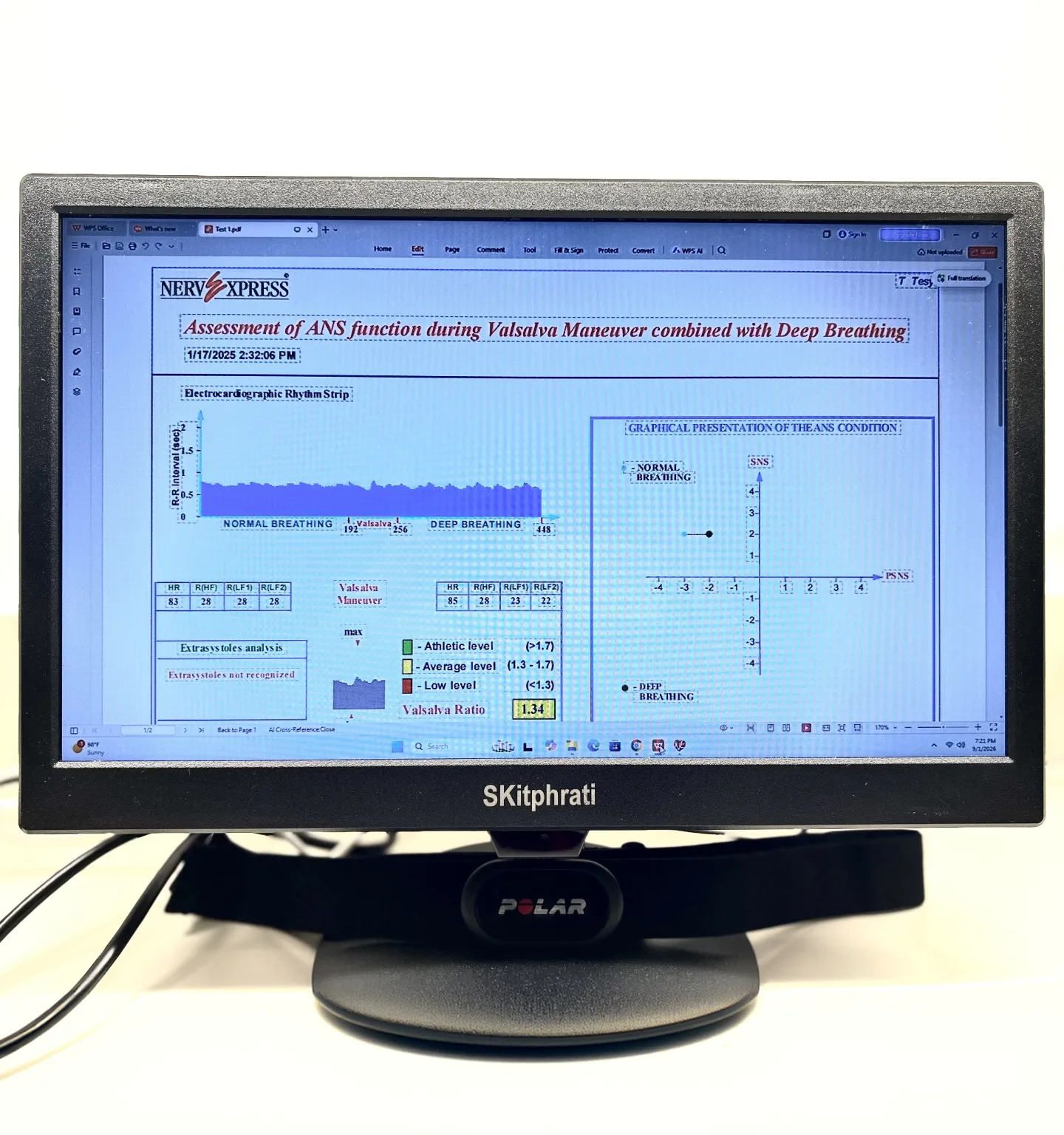A computer monitor displays a Nerve Express heart-rate-variability report with charts and readings, with a heart-rate chest strap draped over its stand